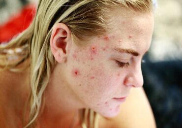 Routine de soins de la peau personnalisée